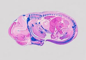 mouse-embryo